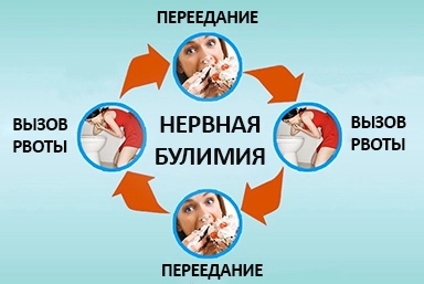Лечение булимии в Шелехове